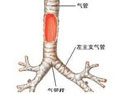 支氣管擴(kuò)張