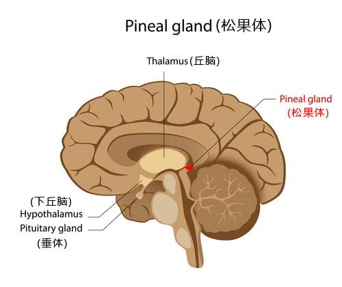 松果體區(qū)瘤
